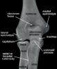 post-51408-13531537267806_thumb.jpg
